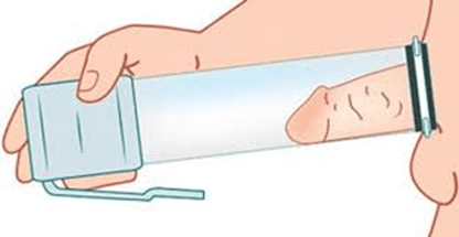 Vacuum Device Therapy